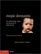 کتاب زبان آتوپیک درماتیتیس  Atopic Dermatitis: The Epidemiology, Causes and Prevention of Atopic Eczema 1st Edition