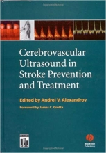 کتاب زبان سربرووسکولار التراسوند این استروک پریونشن اند تریتمنت Cerebrovascular Ultrasound in Stroke Prevention and Treatment