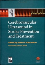 Cerebrovascular Ultrasound in Stroke Prevention and Treatment