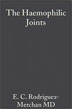 کتاب زبان د هموفیلیک جوینتس The Haemophilic Joints New Perspectives