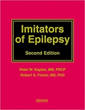 Imitators of Epilepsy 2nd Edition
