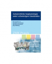 Zahnӓrztliche Implantologie unter schwierigen Umstӓnden