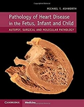 کتاب پاتولوژی آف هارت دیزیز 2019 Pathology of Heart Disease in the Fetus Infant and Child Autopsy Surgical and Molecular Path