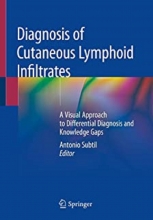 Diagnosis of Cutaneous Lymphoid Infiltrates 1st Edition2019