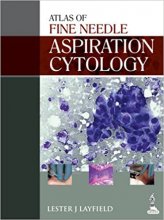 کتاب آسپریشن سایتولوژی Atlas of Fine Needle Aspiration Cytology