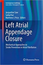 کتاب لفت اتریال اپندیج کلوژر Left Atrial Appendage Closure: Mechanical Approaches to Stroke Prevention in Atrial Fibrillation201