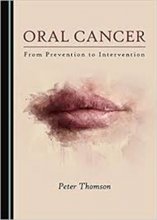 کتاب اورال کانسر Oral Cancer, 1st Edition2019
