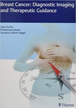 کتاب بریست کانسر Breast Cancer: Diagnostic Imaging and Therapeutic Guidance2017