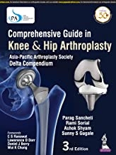 Comprehensive Guide in Knee & Hip Arthroplasty