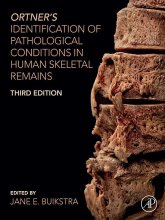 کتاب اورتنرز ایدنتیفیکیشن آف پاتولوژیکال Ortner's Identification of Pathological Conditions in Human Skeletal Remains