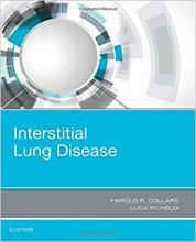 کتاب اینترستیشال لانگ دیزیز Interstitial Lung Disease2017
