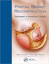 کتاب پارشال بریست ریکانستراکشن Partial Breast Reconstruction, 2nd Edition2017