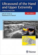 خرید کتاب اولتراسوند آف هند اند آپر اکسترمیتی Ultrasound of the Hand and Upper Extremity2017