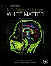 کتاب ام آر آی اطلس آف هیومن وایت ماتر MRI Atlas of Human White Matter, 2nd Edition2010