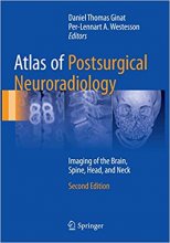 کتاب اطلس آف پست سرجیکال نورورادیولوژی Atlas of Postsurgical Neuroradiology, 2nd Edition2018