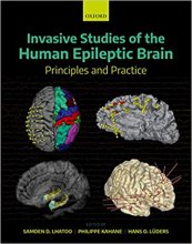 کتاب اینویسیو استادیز آف هیومن اپیلپتیک برین Invasive Studies of the Human Epileptic Brain2019