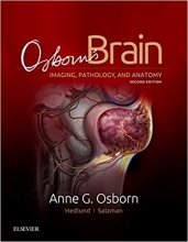 کتاب آزبورنز برین Osborn’s Brain, 2nd Edition2017