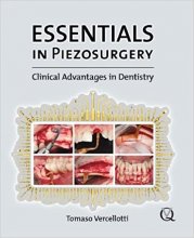 کتاب اسنشالز این پیزوسرجری Essentials in Piezosurgery, 1st Edition2009
