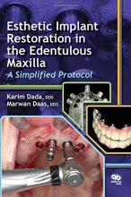 کتاب استتیک ایمپلنت رستوریشن Esthetic Implant Restoration in the Edentulous Maxilla2014