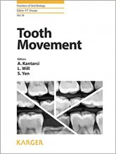 کتاب توث موو منت Tooth Movement
