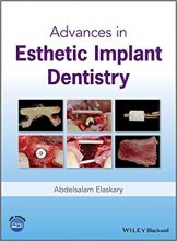 کتاب ادونسز این استتیک ایمپلنت دنتیستری Advances in Esthetic Implant Dentistry