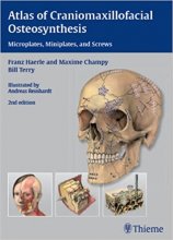 کتاب  اطلس آف کرانیومکسیل اوفیشال  Atlas of Craniomaxillofacial Osteosynthesis : Microplates, Miniplates,and Screws