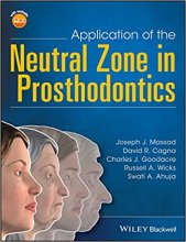 کتاب اپلیکیشن آف نچرال زون این پروستودنتیکس Application of the Neutral Zone in Prosthodontics