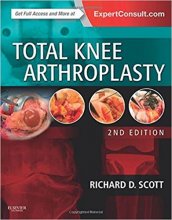 کتاب توتال نی آرتروپلاستی Total Knee Arthroplasty, 2nd Edition2014