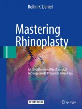 کتاب مسترینگ رینوپلاستی Mastering Rhinoplasty : A Comprehensive Atlas of Surgical Techniques with Integrated Video Clips