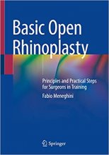 کتاب Basic Open Rhinoplasty : Principles and Practical Steps for Surgeons in Training