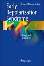 Early Repolarization Syndrome : Etiology and Therapeutics