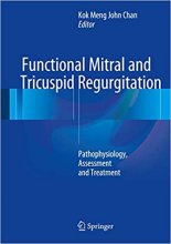 Functional Mitral and Tricuspid Regurgitation : Pathophysiology, Assessment and Treatment