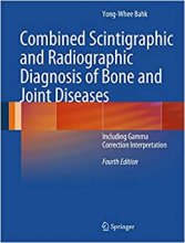 Combined Scintigraphic and Radiographic Diagnosis of Bone and Joint Diseases : Including Gamma Correction Interpretation