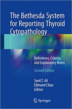 The Bethesda System for Reporting Thyroid Cytopathology : Definitions, Criteria, and Explanatory Notes