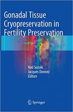 Gonadal Tissue Cryopreservation in Fertility Preservation