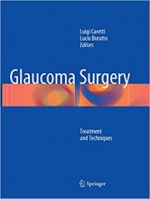 Glaucoma Surgery : Treatment and Techniques