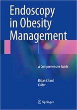 Endoscopy in Obesity Management : A Comprehensive Guide