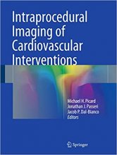 Intraprocedural Imaging of Cardiovascular Interventions