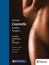 Female Cosmetic Genital Surgery 1st Edition 2017