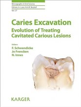 کتاب پزشکی Caries Excavation: Evolution of Treating Cavitated Carious Lesions