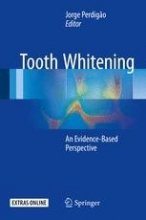 کتاب توث وایتنینگ Tooth Whitening : An Evidence-Based Perspective