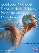 Local and Regional Flaps in Head and Neck Reconstruction